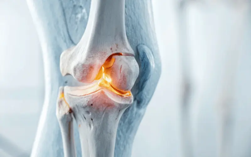 Antalya Diz Hastalıkları Tedavisi: PRP, Radyofrekans ve Rehabilitasyon Yaklaşımları 2026